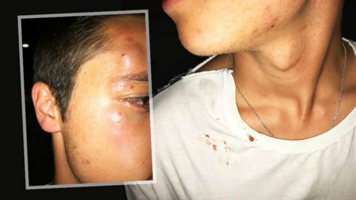 ambiente Vástago secuestrar Las redes muestran su solidaridad con el joven agredido por portar una pulsera de la España Viva | VOX ambiente Vástago secuestrar Las redes muestran su solidaridad con el joven agredido por portar una pulsera de la España Viva | VOX